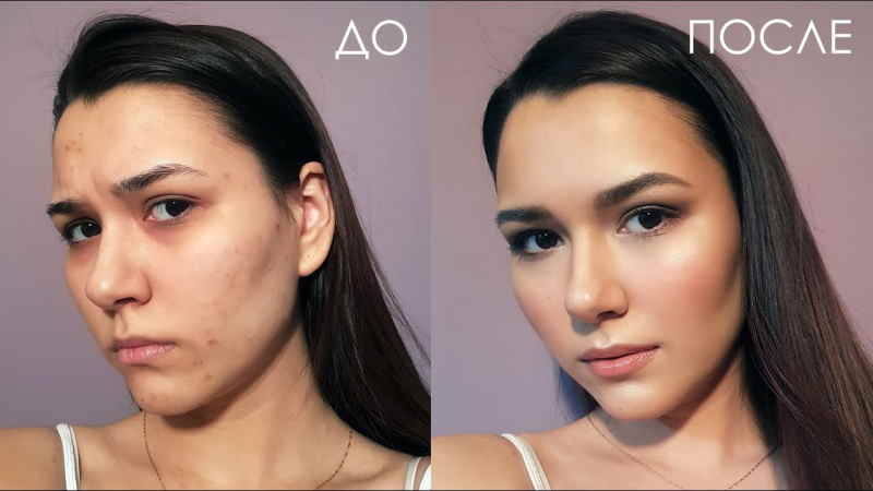 макияж для проблемной кожи фото до и после
