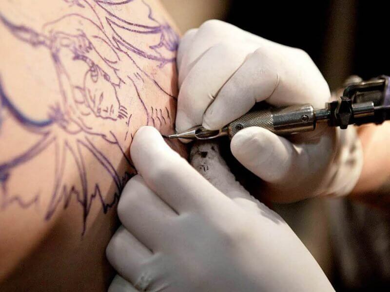 об удалении татуировки