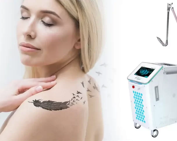 Пикосекундный лазер для удаления татуировок