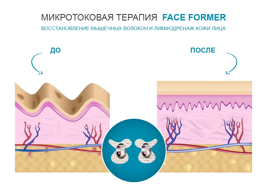 воздействие микротоков на кожу лица