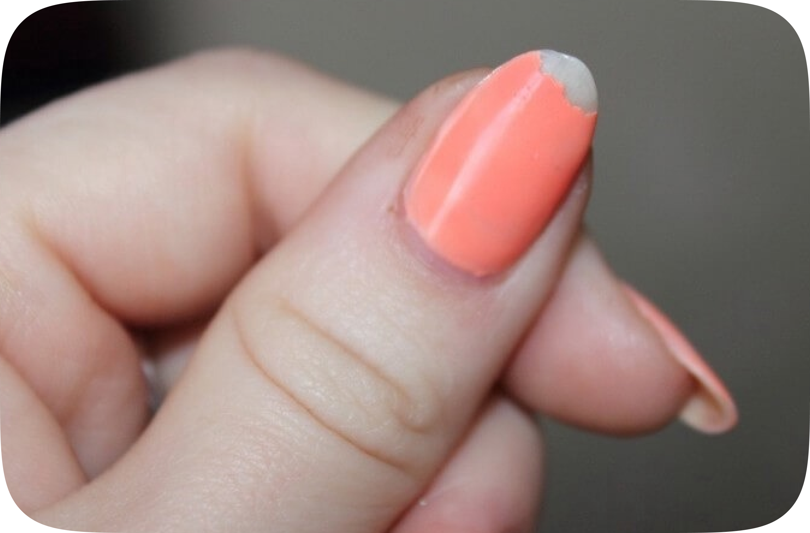 Не держится покрытие на ногтях. Отслаивается гель лак. Скол гель лака. Отслойки на ногтях гель лака.